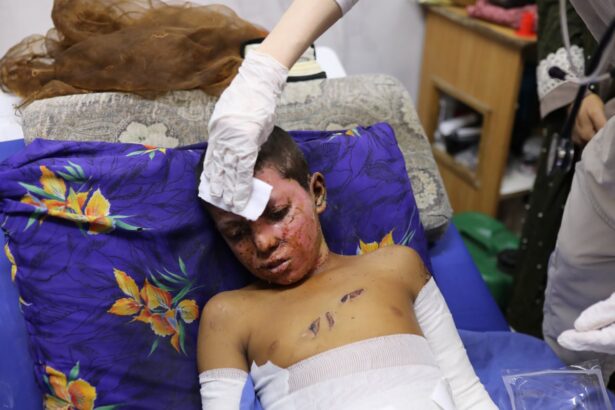 civilian injuries in gaza similar to those of soldiers in war zones study finds 68d5ce45e0786