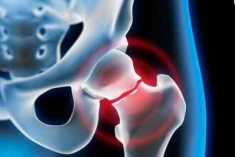 20 octombrie ziua mondiala a osteoporozei 68f5df18e6bed