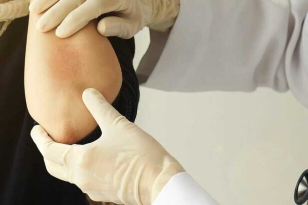 29 octombrie ziua mondiala a psoriazisului world psoriasis day 6901b8fb99a44