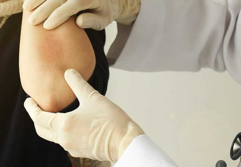 29 octombrie ziua mondiala a psoriazisului world psoriasis day 6901b8fb99a44