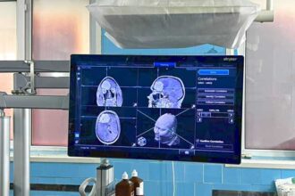 galati premiera medicala prima operatie pe creier realizata cu ajutorul sistemului de neuronavigatie la spitalul judetean 68e91bd5be676