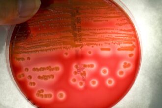 epa urged to ban spraying of antibiotics on us food crops amid resistance fears 692c5c1a3ebb3