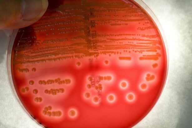 epa urged to ban spraying of antibiotics on us food crops amid resistance fears 692c5c1a3ebb3