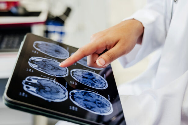 video premiera medicala la spitalul bagdasar arseni din bucuresti operatie pe creier cu pacientul treaz a fost foarte curajos 691c0d27255cc