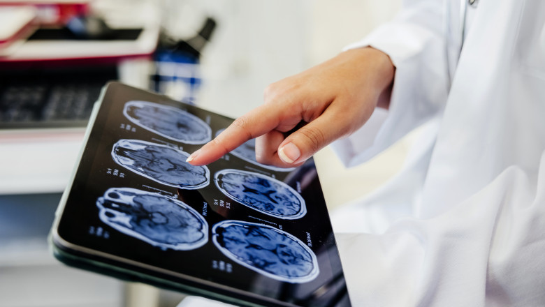 video premiera medicala la spitalul bagdasar arseni din bucuresti operatie pe creier cu pacientul treaz a fost foarte curajos 691c0d27255cc