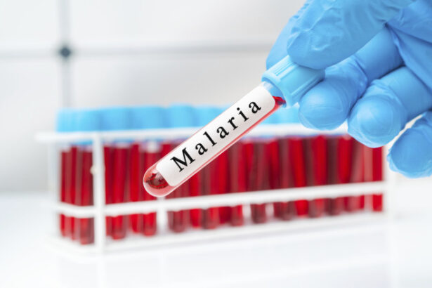 trei cazuri suspecte de malarie la copii dupa o calatorie in africa anuntul ministrului sanatatii 69c154e8282cb